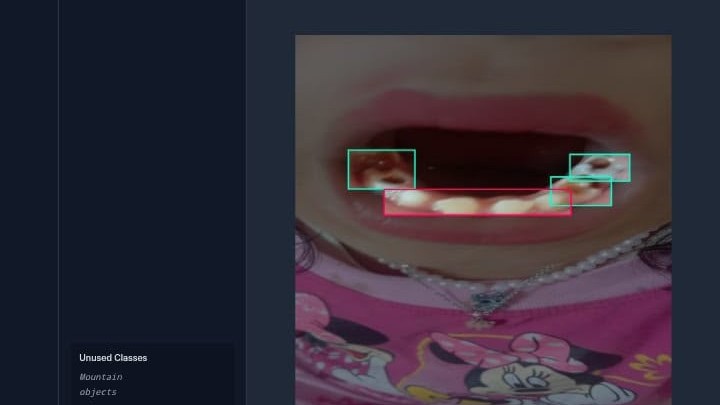 Dental annotation